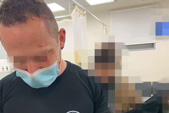 שוטר שנפצע במהלך העימותים // צילום: דוברות המשטרה