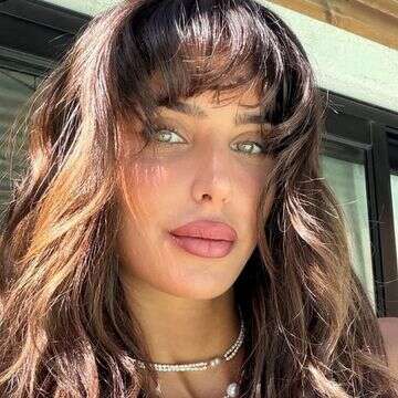 חודש אחרי הניתוח: גל רובין חושפת את התוצאה